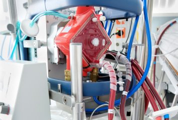 ECMO Unveiled: Exploring Recent Trends in Life-Saving Technology